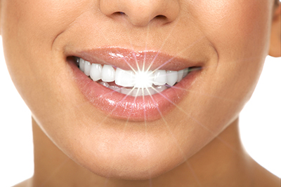 A Brighter Smile for the New Year A Brighter Smile for the New Year