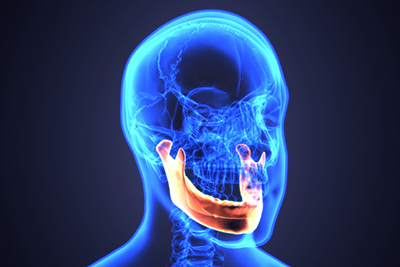 Bone Loss in the Jaw Bone Loss in the Jaw