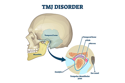 How Does Stress Cause Dental Problems? How Does Stress Cause Dental Problems?