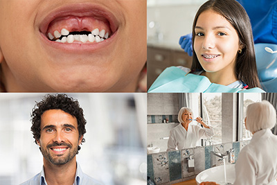 What are the Stages of Tooth Development? What are the Stages of Tooth Development?