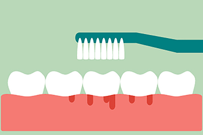 The Hidden Dangers of Gum Disease