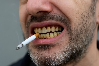 The Impact of Smoking and Tobacco Use on Oral Health