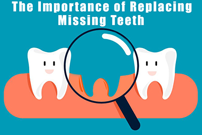 The Importance of Replacing Missing Teeth The Importance of Replacing Missing Teeth