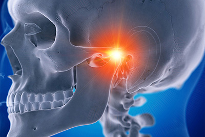What is Temporomandibular Joint Dysfunction?