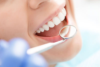 When are Fillings, Crowns and Bridges Necessary?