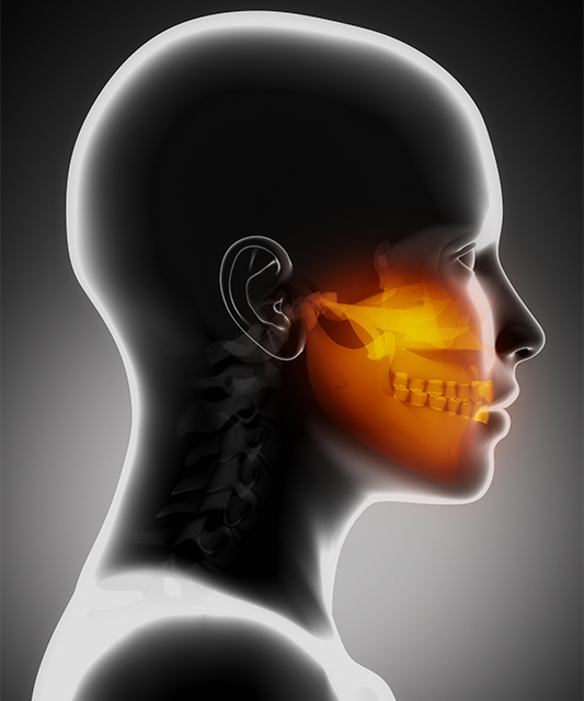 Dental Migraines Dental Migraines